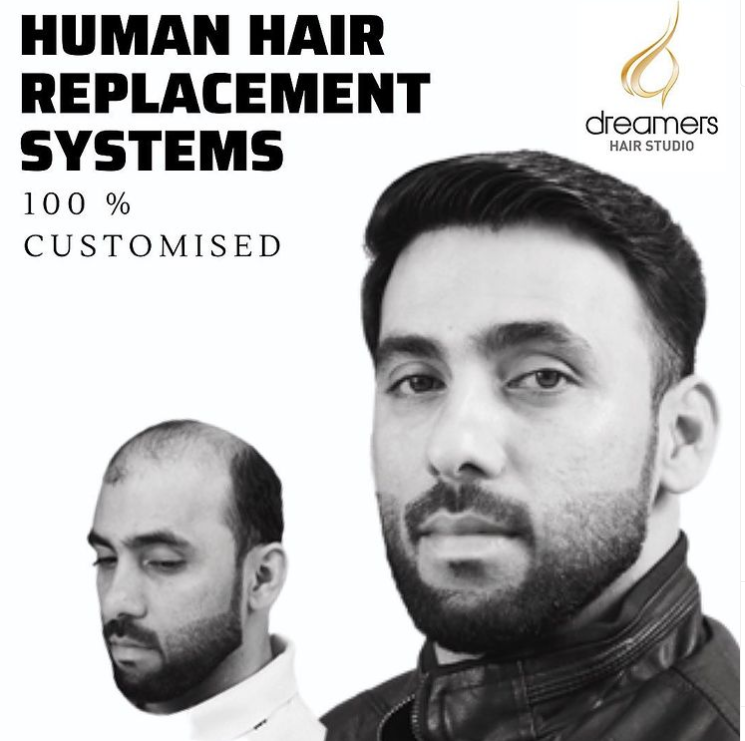 Hair Wigs Clinic Mohali